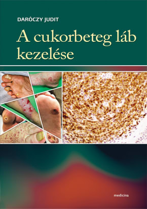 A cukorbeteg láb kezelése 2823